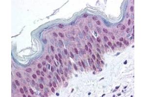 affinity purified anti-HMGN pS20/pS24 antibody was used at 20 ug/ml to detect signal in a variety of tissues including multi-human, multi-brain and multi-cancer slides. (HMGN1 antibody  (pSer20, pSer24))