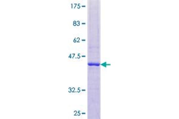 RNASE2 Protein (AA 1-161) (GST tag)