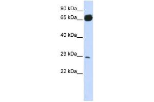 PRTFDC1 antibody used at 1 ug/ml to detect target protein. (PRTFDC1 antibody  (N-Term))
