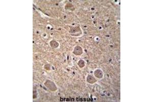 Immunohistochemistry (IHC) image for anti-Tumor Protein P53 Inducible Nuclear Protein 1 (TP53INP1) antibody (ABIN2996348)