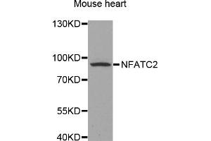 Western blot analysis of extracts of mouse heart, using NFATC2 antibody (ABIN5971589) at 1/500 dilution.