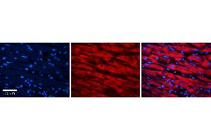 Rabbit Anti-MSRA Antibody Catalog Number: ARP56732_P050 Formalin Fixed Paraffin Embedded Tissue: Human heart Tissue Observed Staining: Cytoplasmic Primary Antibody Concentration: N/A Other Working Concentrations: 1:600 Secondary Antibody: Donkey anti-Rabbit-Cy3 Secondary Antibody Concentration: 1:200 Magnification: 20X Exposure Time: 0. (MSRA antibody  (Middle Region))