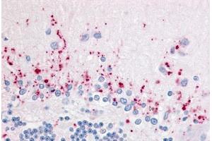 Human Brain, Cerebellum (formalin-fixed, paraffin-embedded) stained with WNT2B antibody ABIN213587 at 5 ug/ml followed by biotinylated goat anti-rabbit IgG secondary antibody ABIN481713, alkaline phosphatase-streptavidin and chromogen. (WNT2B antibody  (Internal Region))