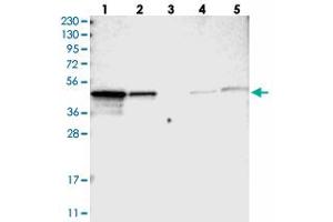 Western blot analysis of Lane 1: RT-4, Lane 2: U-251 MG, Lane 3: Human Plasma, Lane 4: Liver, Lane 5: Tonsil with NDRG3 polyclonal antibody . (NDRG3 antibody)