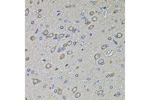 Immunohistochemistry of paraffin-embedded rat brain using PTCD3 antibody. (PTCD3 antibody  (AA 450-689))