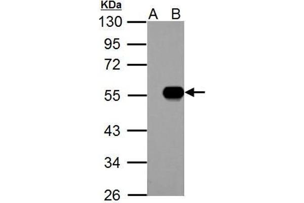 IP6K1 anticorps