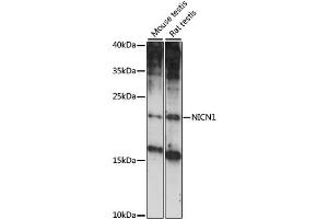 Western blot analysis of extracts of various cell lines, using NICN1 antibody (ABIN6293891) at 1:1000 dilution. (NICN1 antibody)