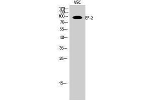 Western Blotting (WB) image for anti-Eukaryotic Translation Elongation Factor 2 (EEF2) (Ser311) antibody (ABIN3174881) (EEF2 antibody  (Ser311))