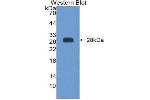 Western Blotting (WB) image for anti-Suppressor of Cytokine Signaling 3 (SOCS3) (AA 1-225) antibody (ABIN3206239) (SOCS3 antibody  (AA 1-225))