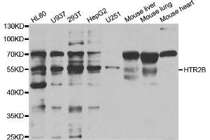 Western Blotting (WB) image for anti-Serotonin Receptor 2B (HTR2B) antibody (ABIN1876871) (Serotonin Receptor 2B antibody)