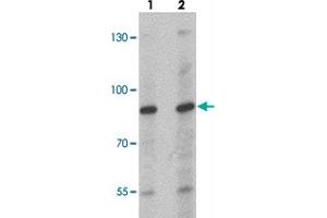 Western blot analysis of NCBP1 in HeLa cell lysate with NCBP1 polyclonal antibody  at (lane 1) 1 and (lane 2) 2 ug/mL. (NCBP1 antibody  (Internal Region))