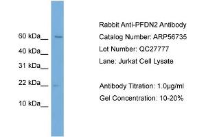 Western Blotting (WB) image for anti-Prefoldin Subunit 2 (PFDN2) (Middle Region) antibody (ABIN2786872) (PFDN2 antibody  (Middle Region))