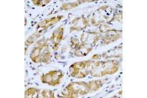 Immunohistochemical analysis of SETD5 staining in human stomach formalin fixed paraffin embedded tissue section. (SETD5 antibody)