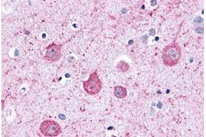 Immunohistochemical staining of human brain, neurons and glia with LPHN2 polyclonal antibody . (LPHN2 antibody  (C-Term))