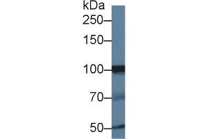 Western blot analysis of Human Jurkat cell lysate, using Human INPP4A Antibody (1 µg/ml) and HRP-conjugated Goat Anti-Rabbit antibody (