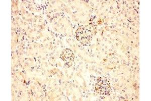 IHC-P: ACTH antibody testing of mouse kidney tissue (ACTH antibody  (Middle Region))