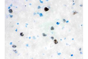 Anti- VCP Picoband antibody, IHC(F): Rat Brain Tissue (VCP antibody  (C-Term))