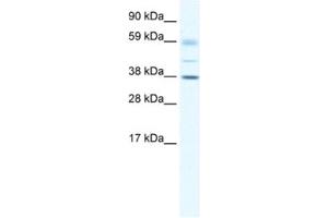 Western Blotting (WB) image for anti-SRY (Sex Determining Region Y)-Box 17 (SOX17) antibody (ABIN2460679) (SOX17 antibody)