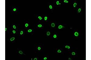 Immunofluorescence staining of Hela cells (treated with 30mM sodium butyrate for 4h) with ABIN7139175 at 1:5, counter-stained with DAPI. (HIST1H3A antibody  (acLys27))