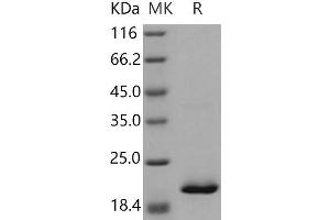 Western Blotting (WB) image for Retinol Binding Protein 4, Plasma (RBP4) (Active) protein (His tag) (ABIN7320388) (RBP4 Protein (His tag))