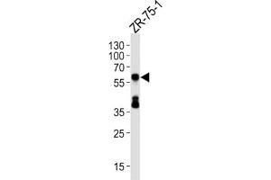 Western Blotting (WB) image for anti-delta Like Protein 3 (DLL3) antibody (ABIN5024655) (DLL3 antibody)