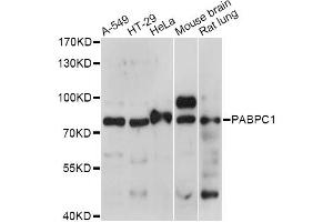 Western blot analysis of extracts of various cell lines, using PABPC1 antibody. (PC1 antibody)