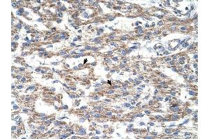 DUT antibody was used for immunohistochemistry at a concentration of 4-8 ug/ml to stain Myocardial cells (arrows) in Human Heart. (Deoxyuridine Triphosphatase (DUT) (C-Term) antibody)