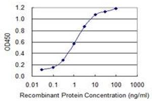 Detection limit for recombinant GST tagged SEPT9 is 0. (Septin 9 antibody  (AA 26-125))