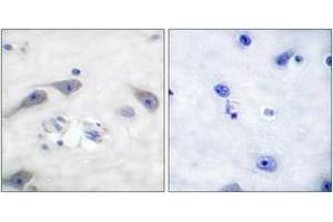 Immunohistochemistry analysis of paraffin-embedded human brain tissue, using DARPP-32 (Ab-75) Antibody. (DARPP32 antibody  (AA 41-90))