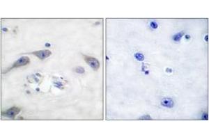Immunohistochemistry analysis of paraffin-embedded human brain tissue, using DARPP-32 (Ab-75) Antibody.