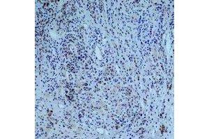 Immunohistochemical analysis of Collagen 3 alpha 1 staining in human skin formalin fixed paraffin embedded tissue section. (COL3A1 antibody)