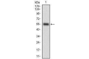 Western blot analysis using CD38 mAb against human CD38 (AA: Extra(43-300)) recombinant protein.