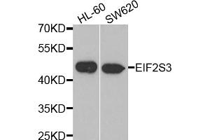 Western blot analysis of extracts of various cell lines, using EIF2S3 antibody (ABIN5975415) at 1/1000 dilution.