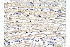 FBXL11 antibody was used for immunohistochemistry at a concentration of 4-8 ug/ml to stain Skeletal muscle cells (arrows) in Human Muscle.