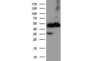 Western Blotting (WB) image for anti-Tubulin, alpha-Like 3 (TUBAL3) (AA 150-446) antibody (ABIN1490960) (TUBAL3 antibody  (AA 150-446))