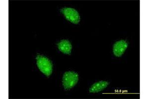 Immunofluorescence of monoclonal antibody to FLI1 on HeLa cell. (FLI1 antibody  (AA 1-452))