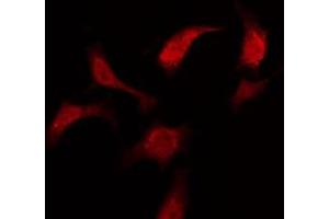 ABIN6275984 staining Hela by IF/ICC. (LPAR3 antibody  (Internal Region))