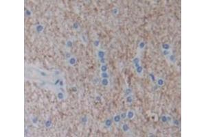 IHC-P analysis of Human Tissue, with DAB staining. (IFNA5 antibody  (AA 22-189))