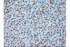 Immunohistochemical staining of paraffin-embedded liver tissue using anti-TRPM4mouse monoclonal antibody.