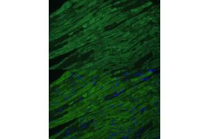 Immunofluorescence analysis of mouse heart cells using TNNI3 antibody (ABIN6132729, ABIN6149357, ABIN6149359 and ABIN6213640) at dilution of 1:100. (TNNI3 antibody  (AA 1-210))