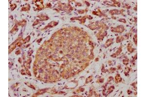 Immunohistochemistry (IHC) image for anti-CD63 (CD63) (AA 103-203) antibody (ABIN7147175)