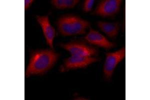 Immunofluorescenitrocellulosee of human HeLa cells stained with Hoechst 3342 (Blue) for nucleus staining and monoclonal anti-human BAK1 antibody (1:500) with Texas Red (Red).