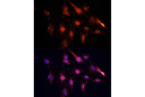 Immunofluorescence analysis of C6 cells using NSUN2 antibody (ABIN1681117, ABIN3017797, ABIN3017798 and ABIN6220260) at dilution of 1:100.