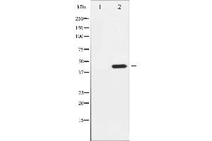 Western blot analysis of Tyrosine Hydroxylase phosphorylation expression in Insulin treated 293 whole cell lysates,The lane on the left is treated with the antigen-specific peptide.
