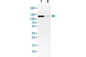 Western Blot (Cell lysate) analysis with CTNND1 polyclonal antibody  Lane 1: NIH-3T3 cell lysate (Mouse embryonic fibroblast cells) Lane 2: NBT-II cell lysate (Rat Wistar bladder tumour cells) (CTNND1 antibody)