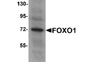 Western Blotting (WB) image for anti-Forkhead Box O1 (FOXO1) (N-Term) antibody (ABIN1031383) (FOXO1 antibody  (N-Term))