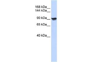 WB Suggested Anti-ACTN1 Antibody Titration: 0. (ACTN1 antibody  (N-Term))