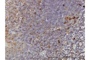 Immunostaining (ISt) image for anti-T-Complex 1 (TCP1) (AA 1-556) antibody (ABIN563128)