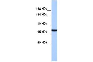 PCDH15 antibody used at 1 ug/ml to detect target protein. (PCDH15 antibody  (N-Term))