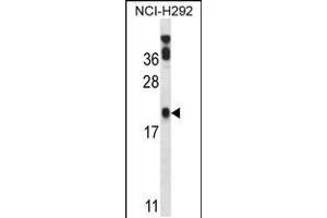 Western blot analysis in NCI-H292 cell line lysates (35ug/lane). (PERP antibody  (C-Term))